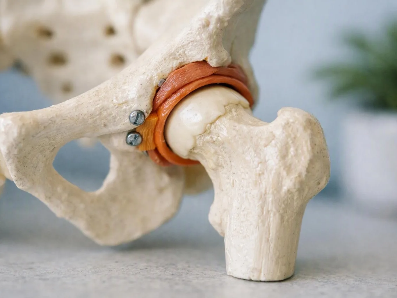 A close-up model shows a hip joint with bone, screws, and orange rings on a tabletop